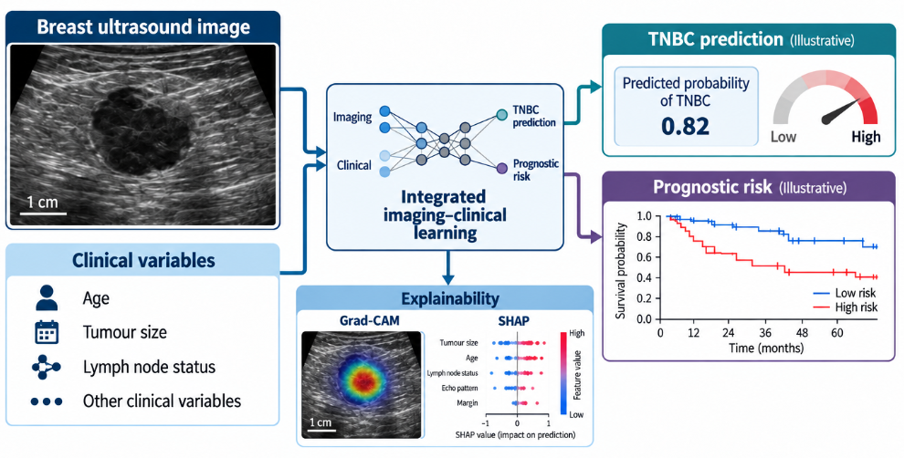 Integrated imaging–clinical learning framework for TNBC prediction and prognostic risk, with Grad-CAM and SHAP explainability (illustrative overview)